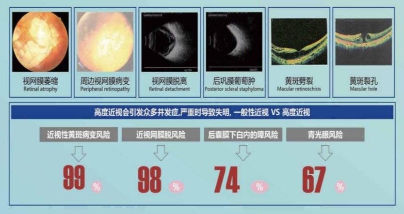 风暴平台登录：AI如何从眼里掘金？